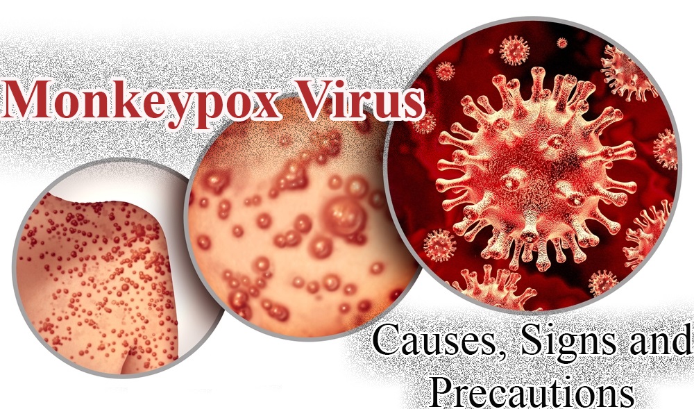 What is MonkeyPox